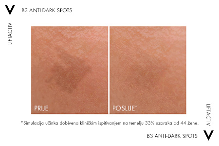 Vichy Liftactiv B3 Serum 2