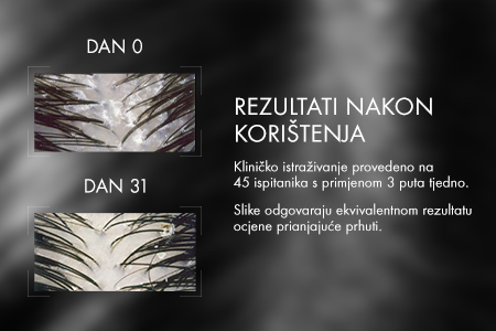 Vichy Dercos AD 200 ml 3